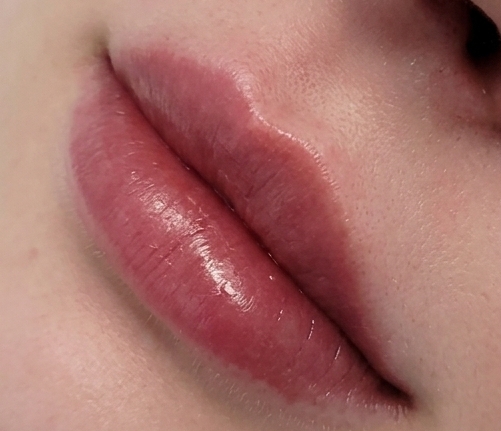 Lip Lines Before
