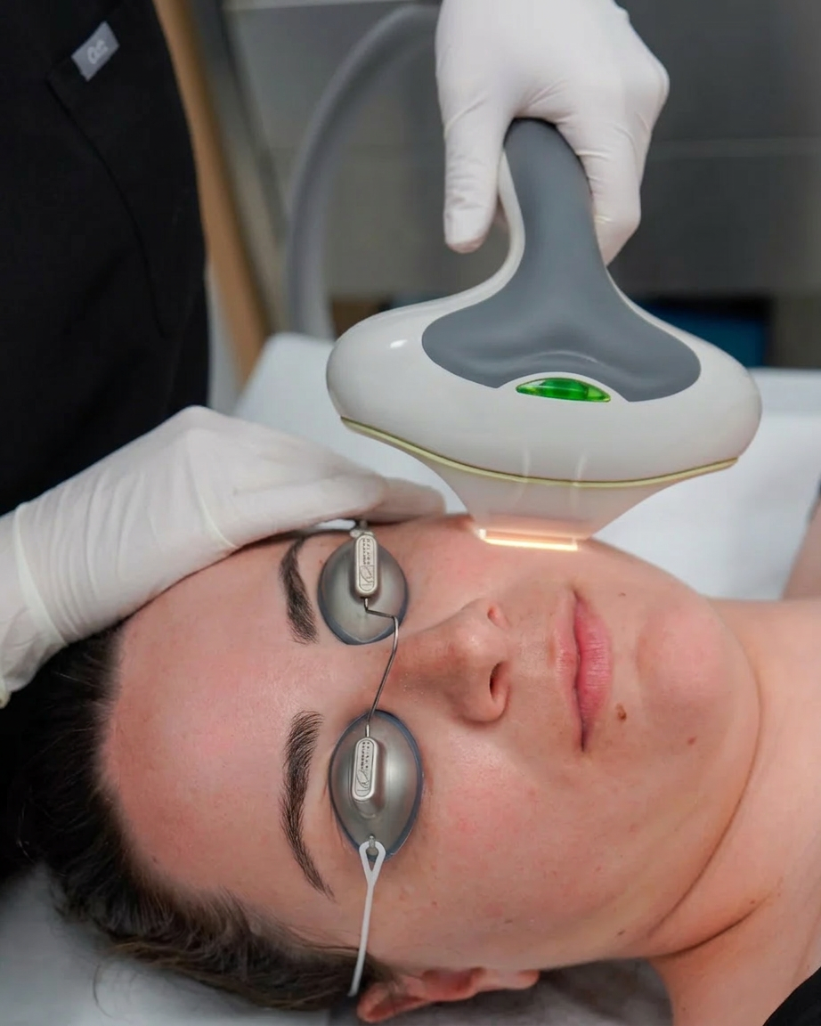 IPL Treatment Context